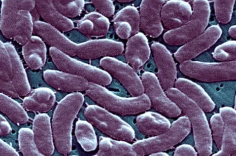 Louisiana Confirms 5 Deaths from Flesh-Eating Bacteria in Gulf Seawater